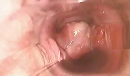 Ông nội tâm lý cho người video xx nhat ban trầm cảm để cháu ở miệng của mình và bình tĩnh ass